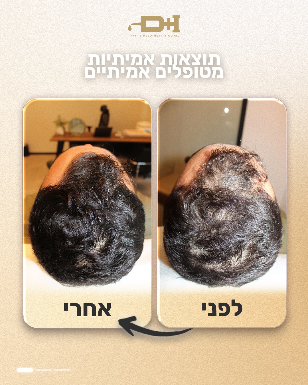 תוצאות לפני ואחרי טיפול 1