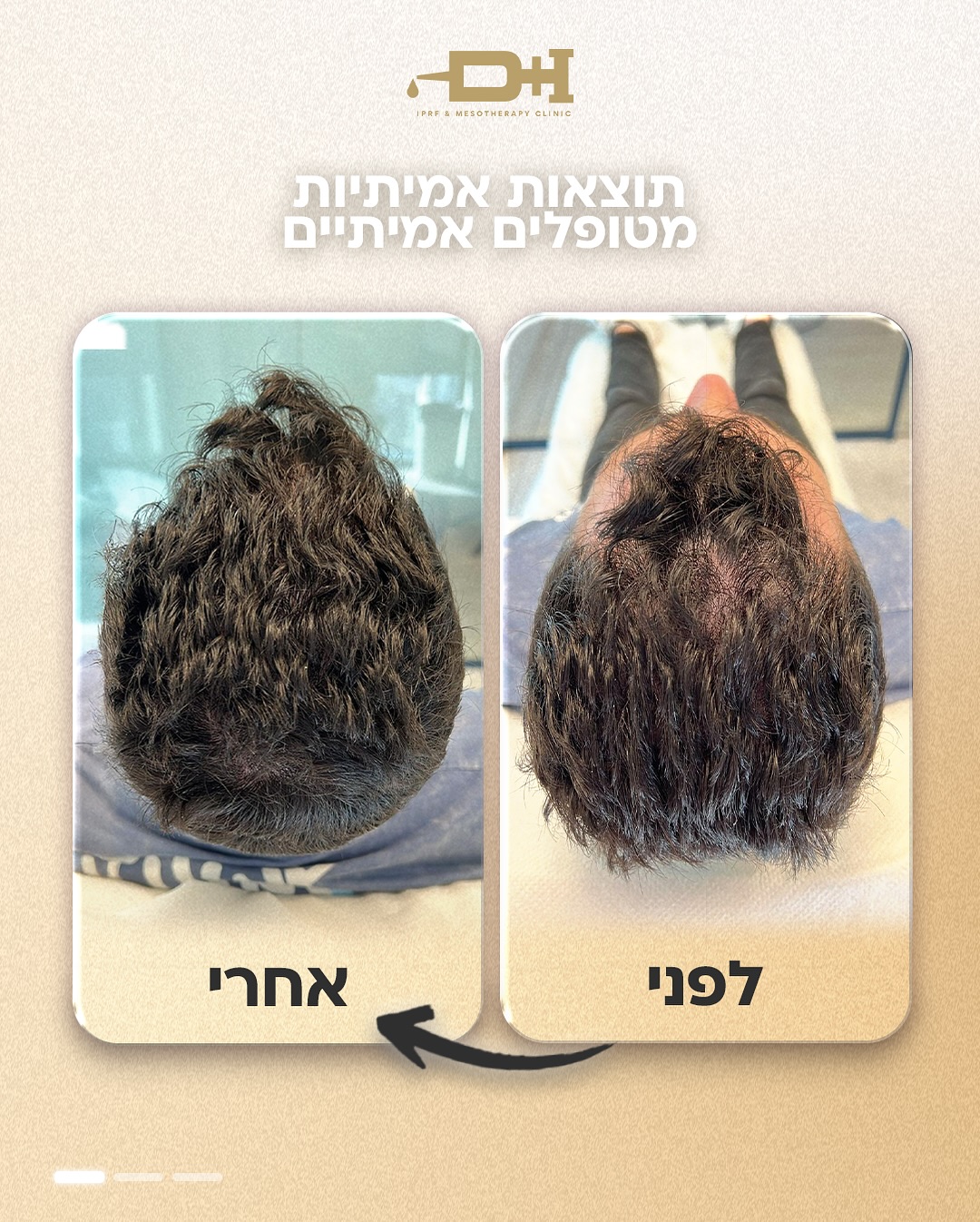 תוצאות לפני ואחרי טיפול 2