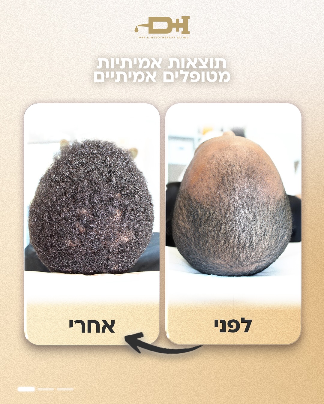 תוצאות לפני ואחרי טיפול 3